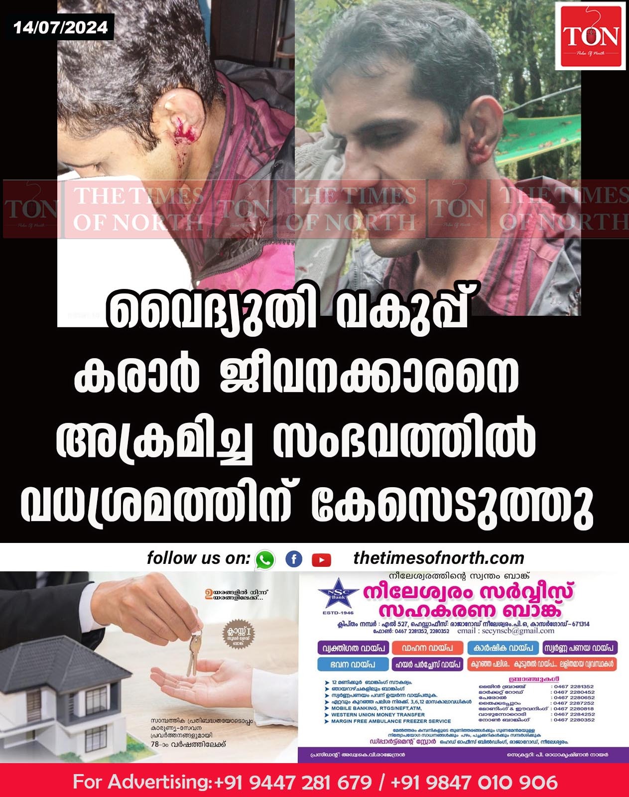 വൈദ്യുതി വകുപ്പ് കരാർ ജീവനക്കാരനെ അക്രമിച്ച സംഭവത്തിൽ വധശ്രമത്തിന് കേസെടുത്തു