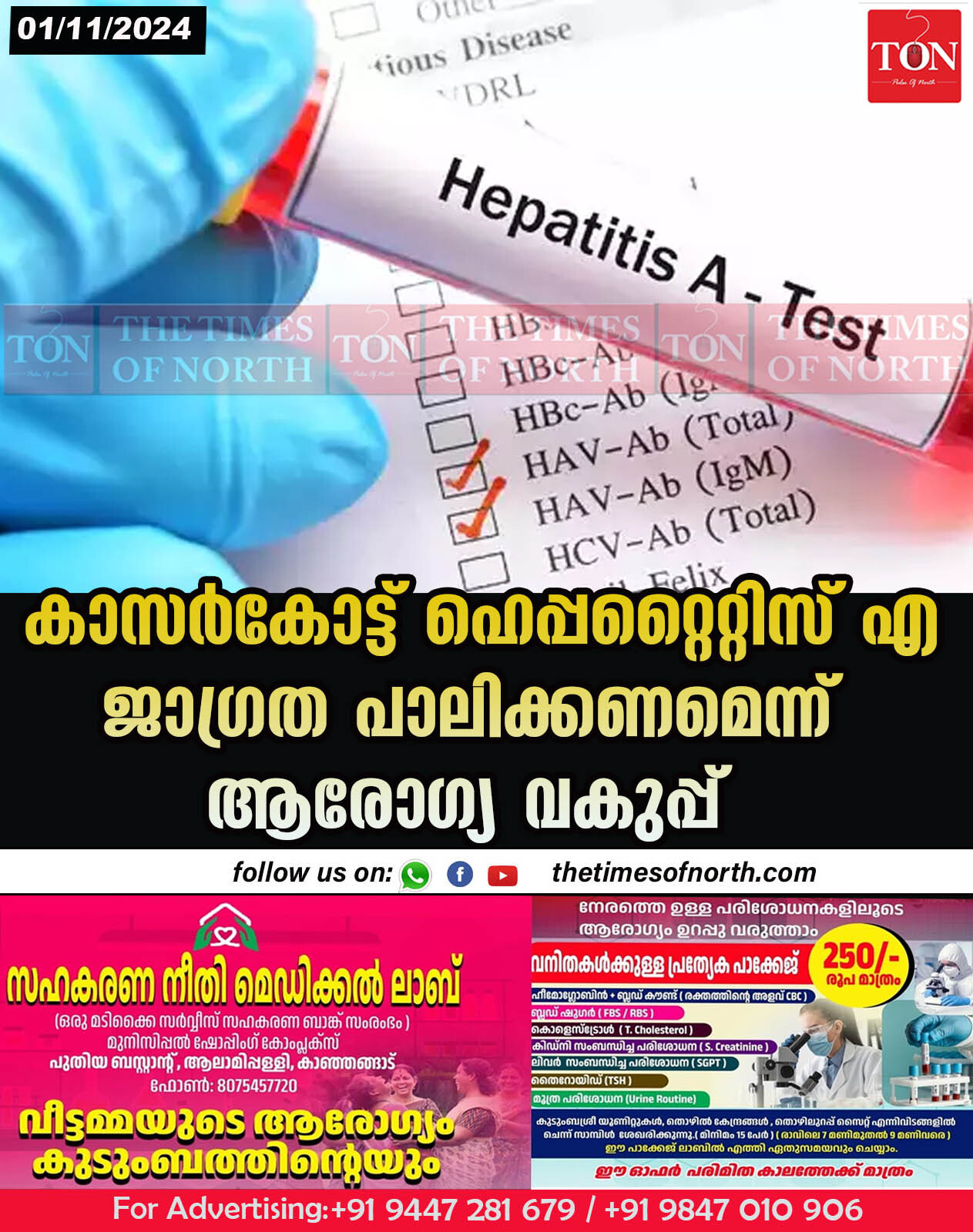 കാസർകോട്ട് ഹെപ്പറ്റൈറ്റിസ് എ ജാഗ്രത പാലിക്കണമെന്ന് ആരോഗ്യ വകുപ്പ്